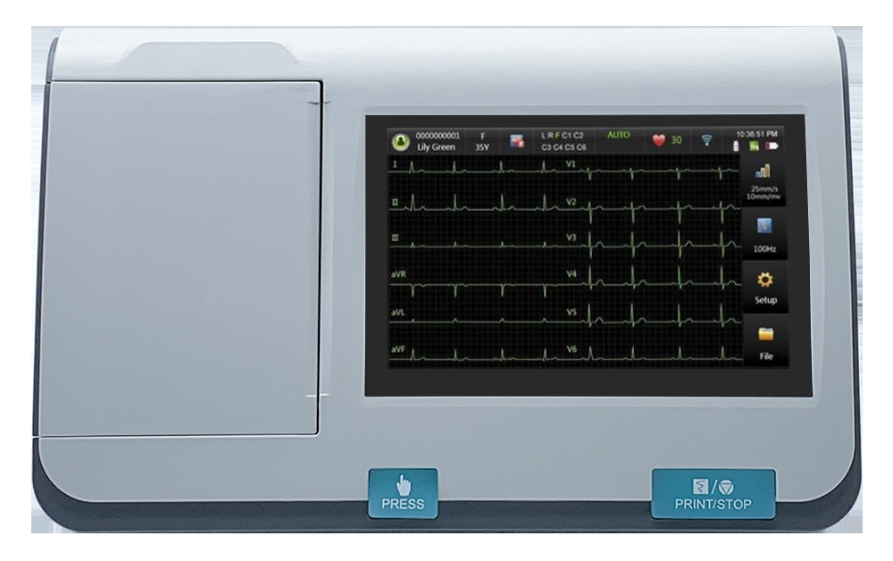https://s3.vistaartrade.anukul.com.np/vistaartrade/media/products/2022/05/06/SE-301-screen_pnfzBdk.webp