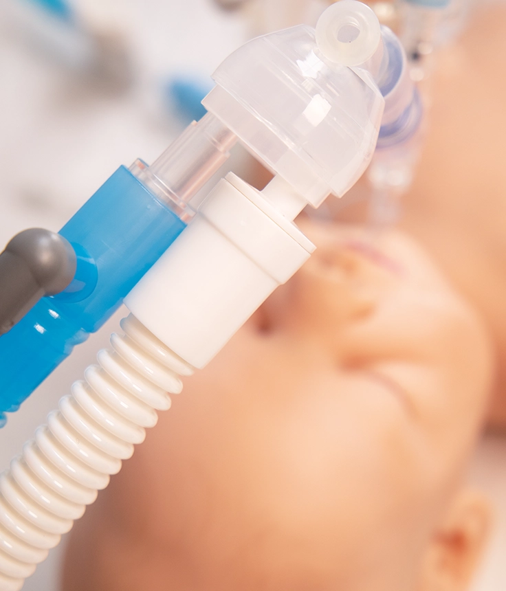 https://s3.vistaartrade.anukul.com.np/vistaartrade/media/products/2022/09/01/VentiMyst_Neonatal.webp