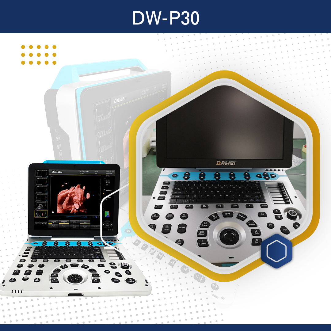 https://s3.vistaartrade.anukul.com.np/vistaartrade/media/products/2024/05/18/Dw-P30.1.jpg