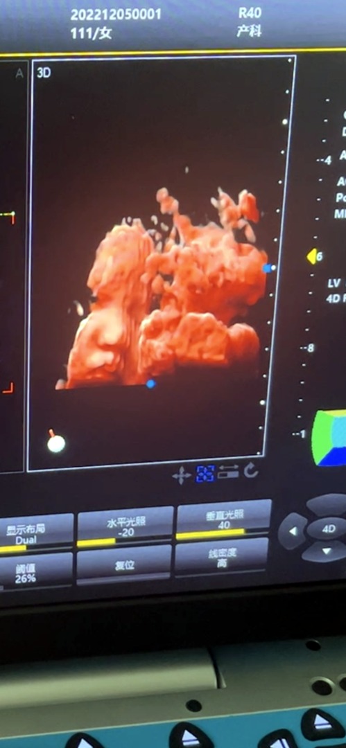 Preview image 1